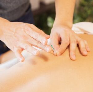 From above of crop anonymous man applying needles on back of client during acupuncture procedure